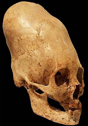 Загадки странных черепов, Эхнатон и Нефертити